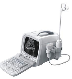 全数字超声诊断系统 (ZQ-6600)